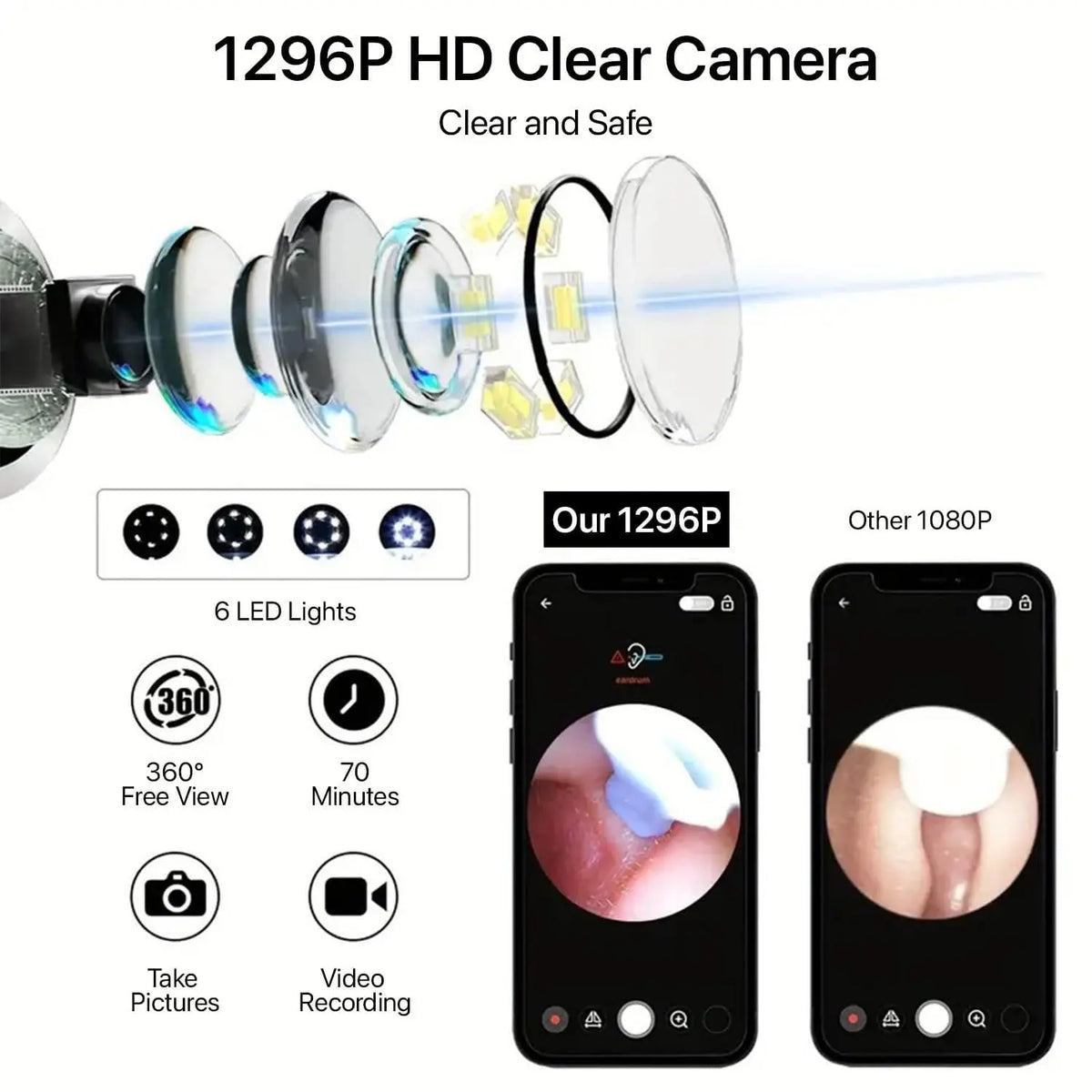 Earwax Removal Tool Kit with HD Camera Wi-Fi Connection - FIX IT STORE