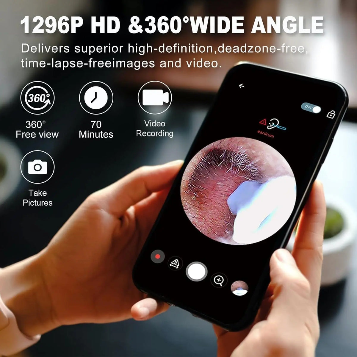 Earwax Removal Tool Kit with HD Camera Wi-Fi Connection - FIX IT STORE